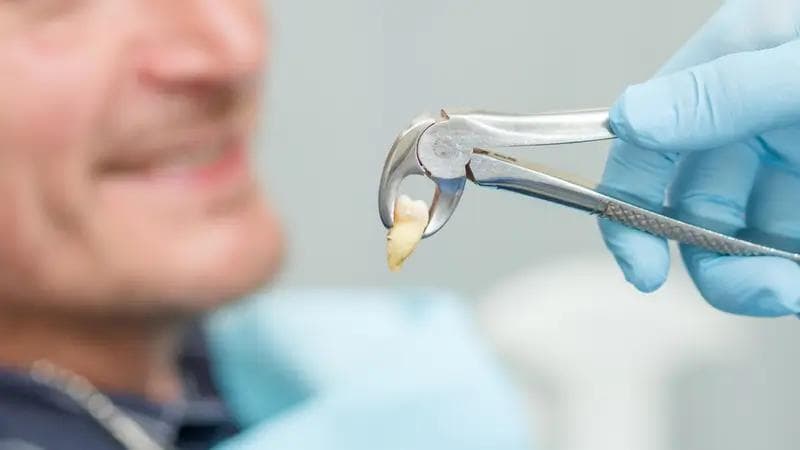Top 5 Implant Clinics